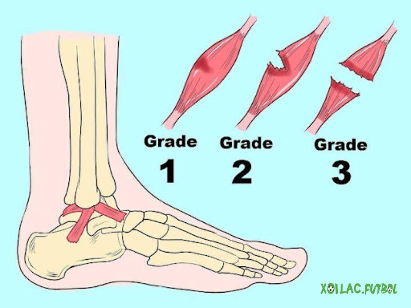 Các dạng lật sơ mi là gì?